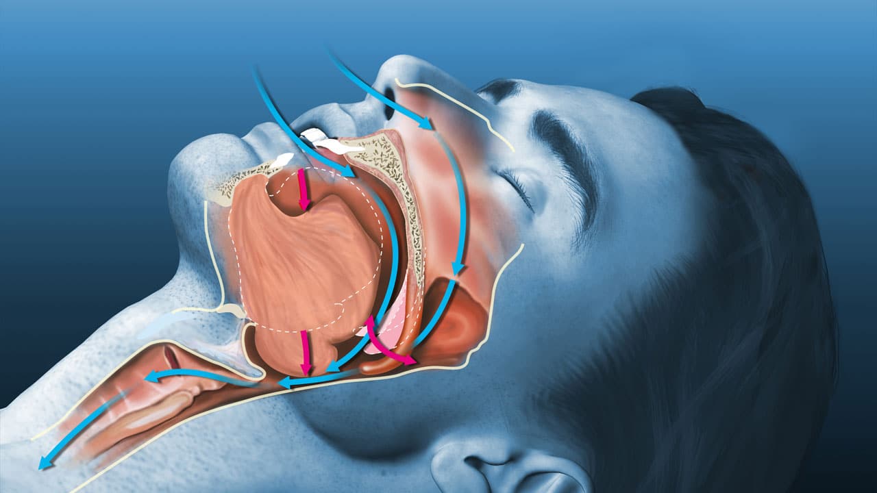 Graphic showing the mouth and airway