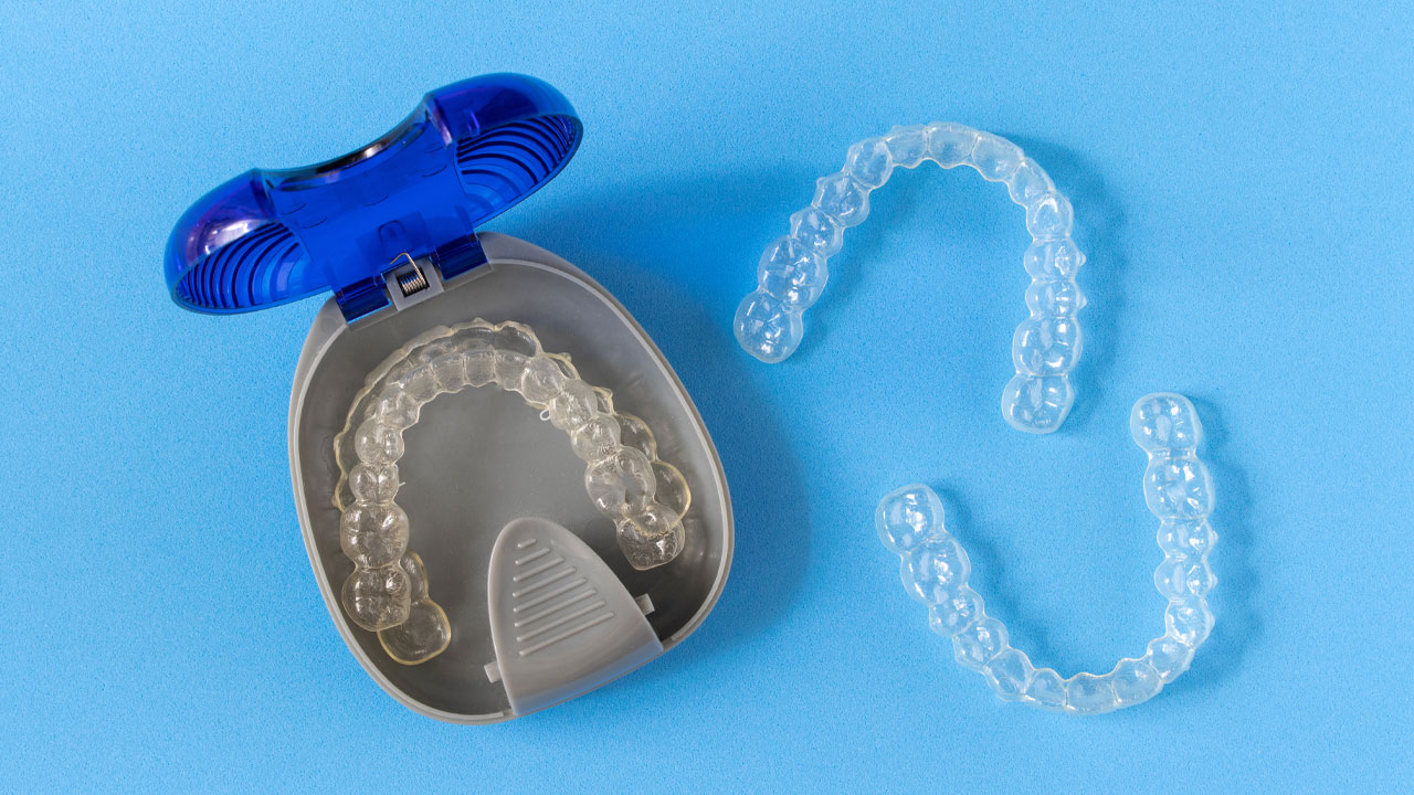 Clear tray aligners for straighter teeth