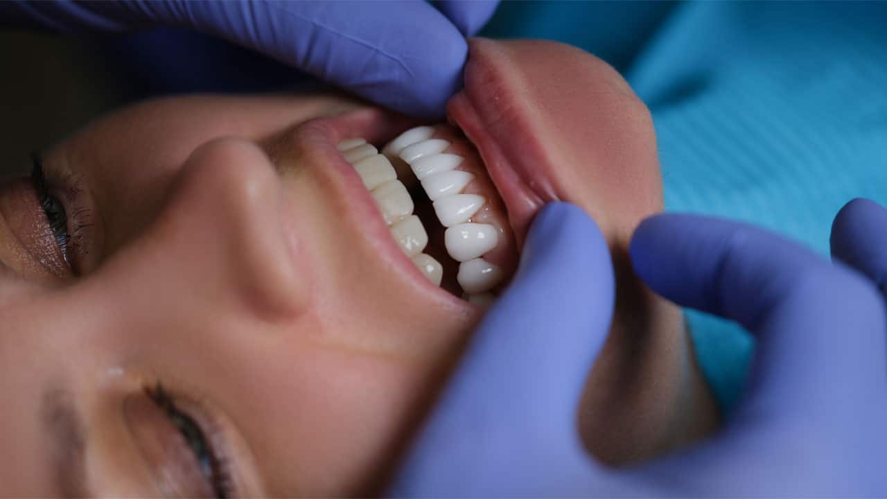 Woman at dentist getting veneers