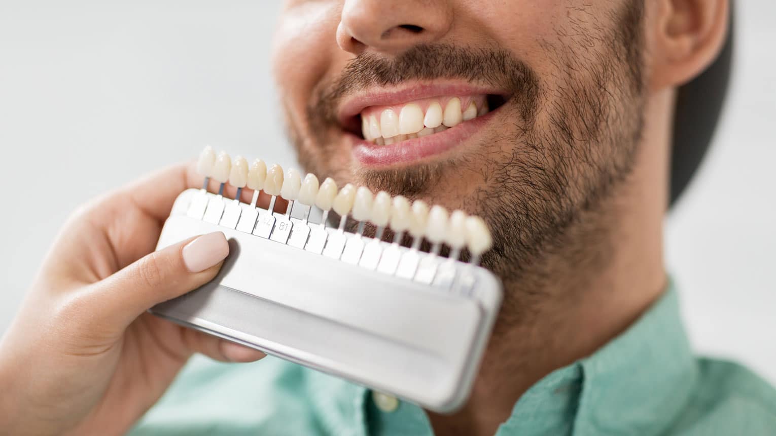Dental Veneers: Process, Benefits, and Care