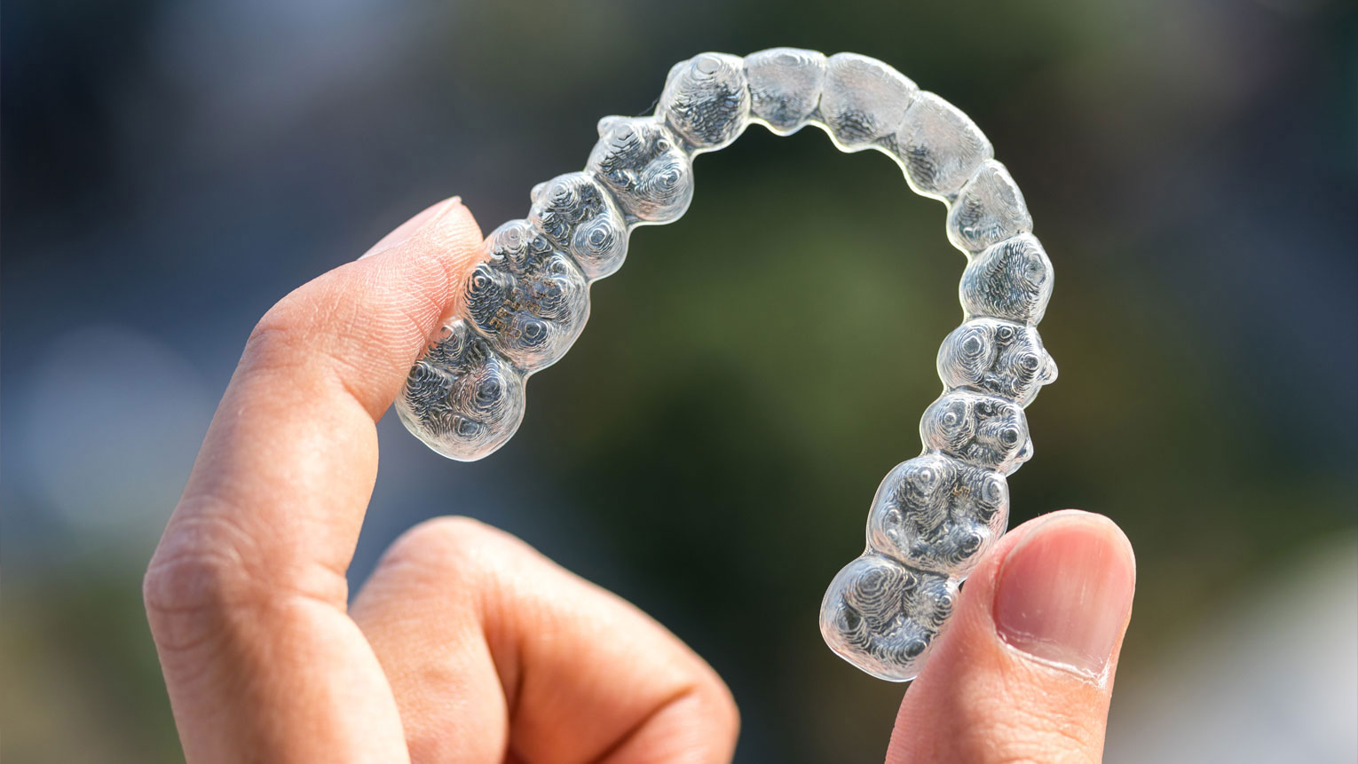 How Does Invisalign Work? A Step-by-Step Guide - Smile On Dental Salon ...