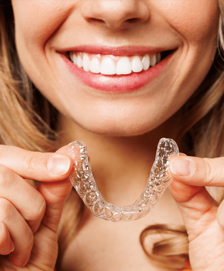 Invisalign clear aligners for straightening teeth