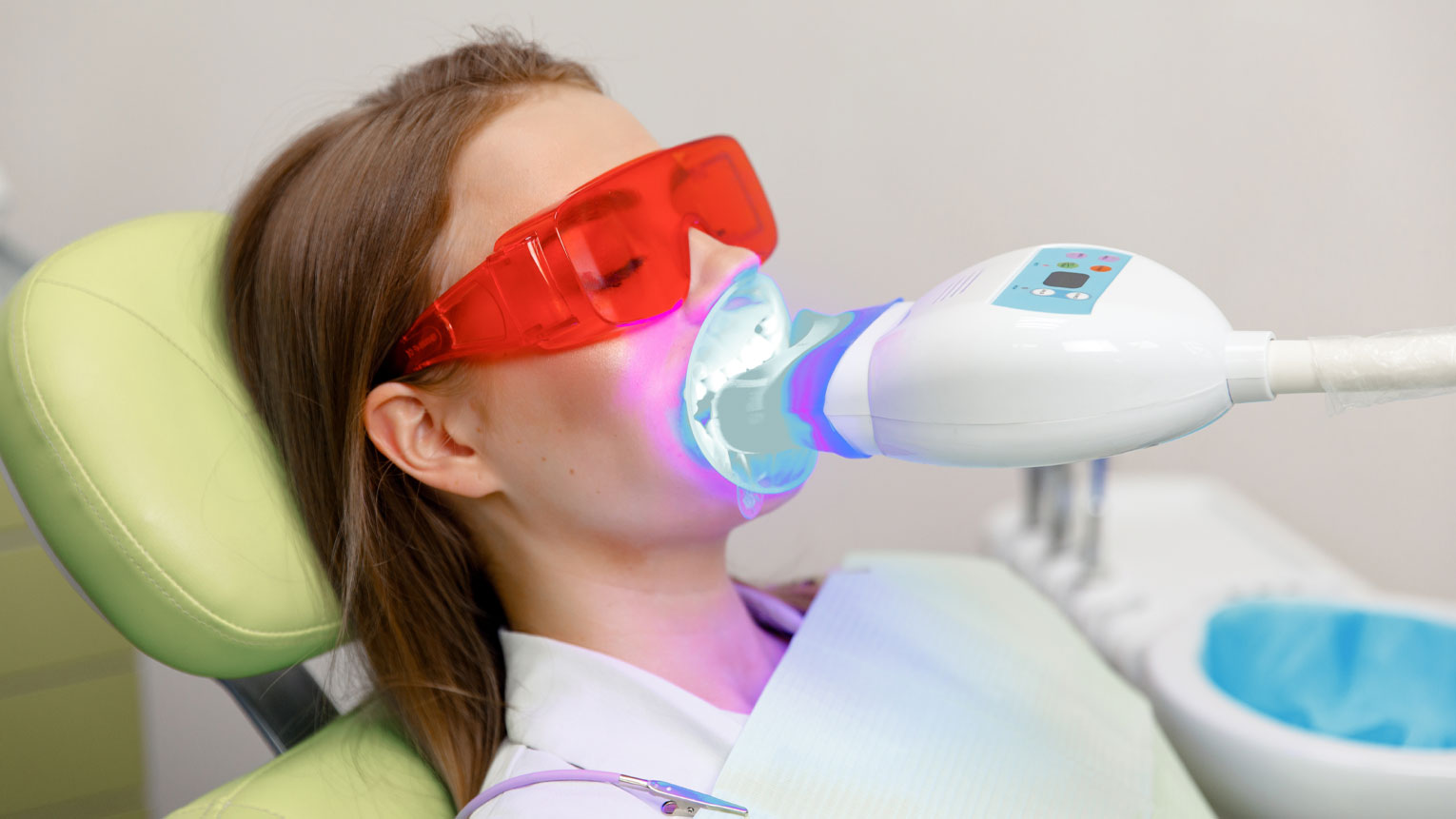 Professional Teeth Whitening: What to Expect