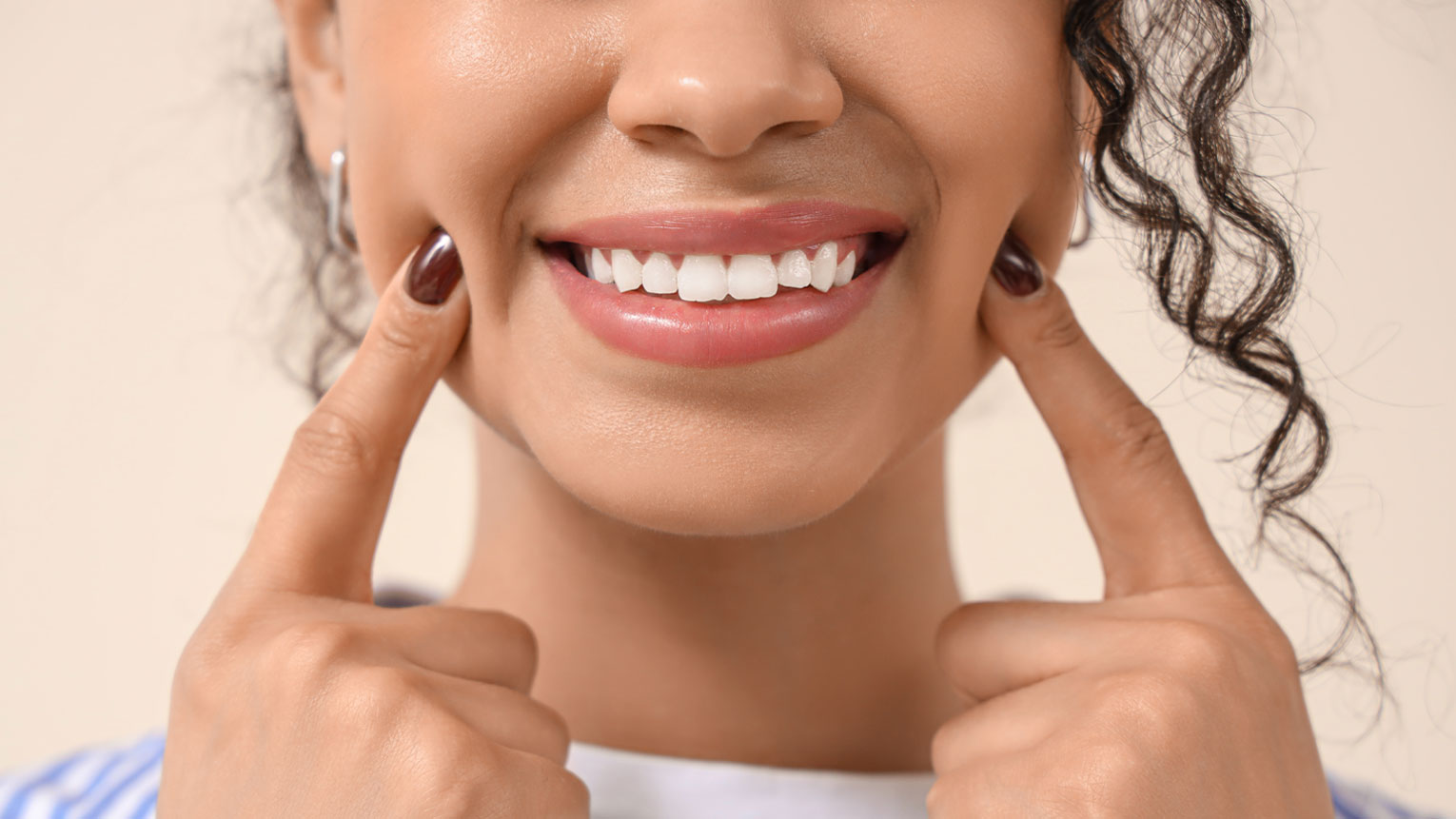What Is a Smile Makeover and Is It Right For You?