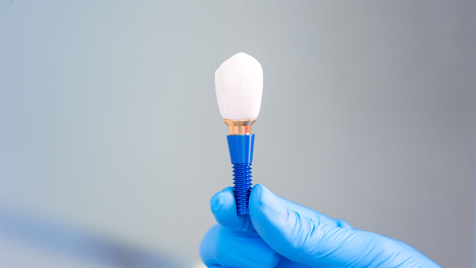 What to Expect During a Dental Implant Procedure